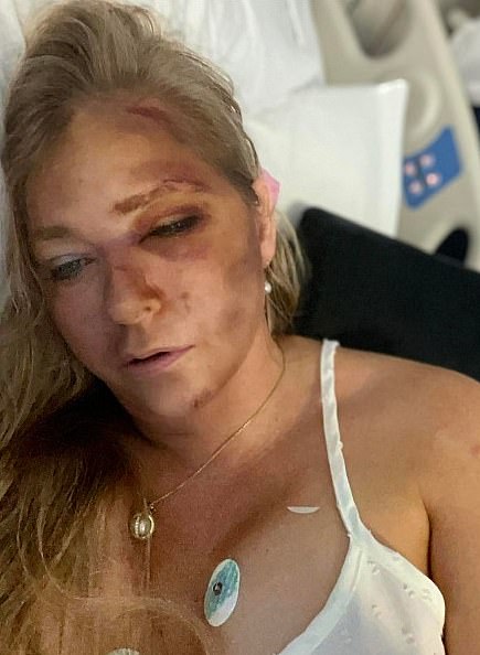 Virginia Giuffre posted online last month about being hospitalised and said she only had four days to live after a bus crash