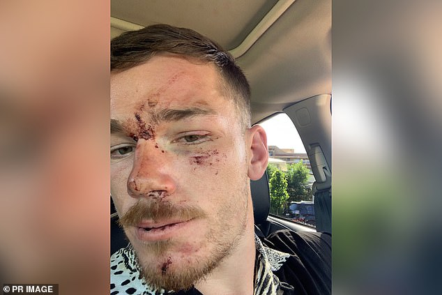 The now-26-year-old rugby league player had been with his parents and brothers Jackson, 29, and Josh, 24, at Shady Palms restaurant on the NSW Central Coast