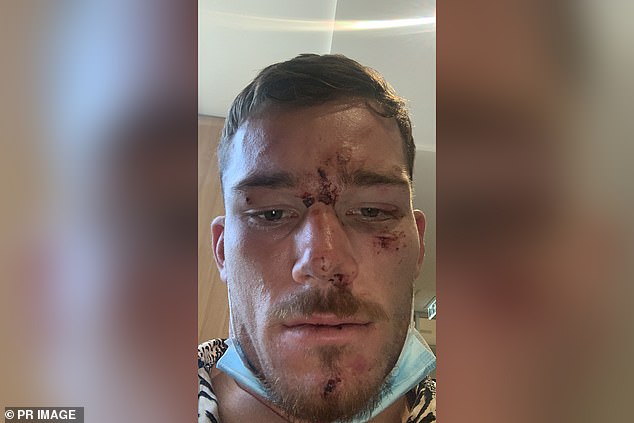 The incident is alleged to have taken plaec after his mother was said to have been insulted by a security guard