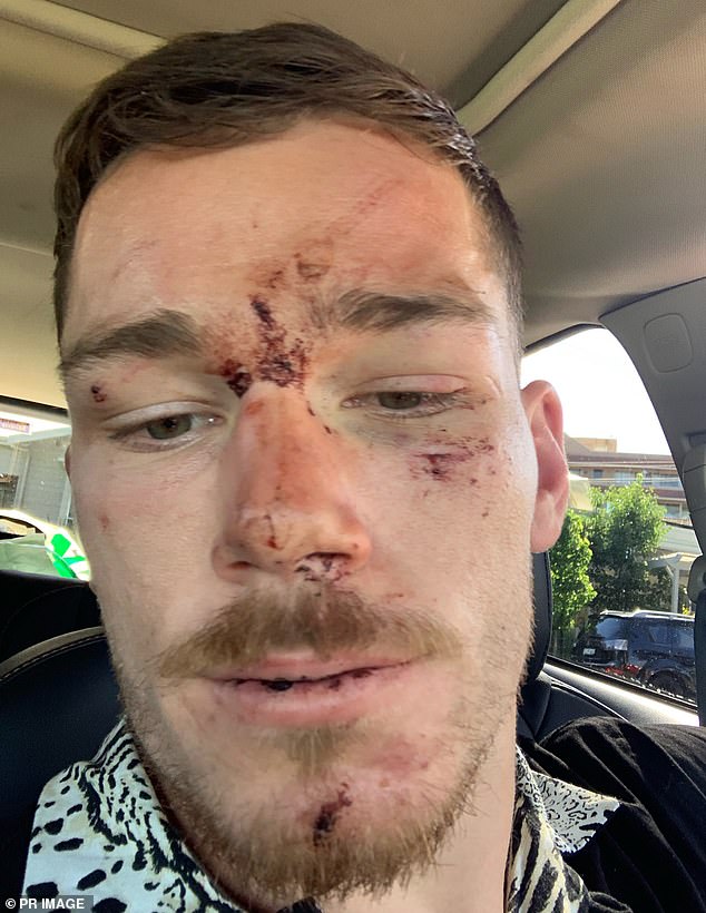 Canberra Raiders hooker Starling was allegedly set upon by police and punched in the head until he blacked out during the December 2020 incident at a NSW bar