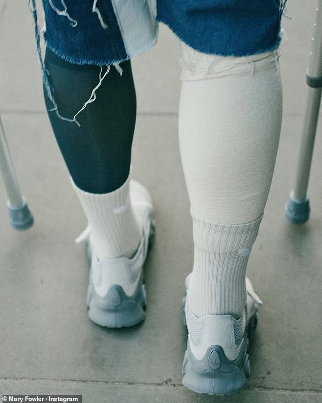 Fowler had also shared a snap of her leg wrapped in a compression bandage as she walked down the street on crutches