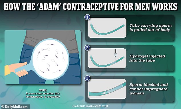 The above graphic demonstrates how the hydrogel blocks sperm from exiting the body, helping a man avoid getting a woman pregnant. Doctors are not sure whether it is reversible, but have shown the gel is effective at blocking sperm for at least two years.