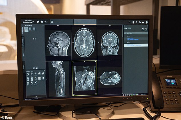 Scan results showing the brain, spine, pelvis and abdomen. Any abnormalities will be flagged to the patient, who can then take the scans to their GP for further investigation