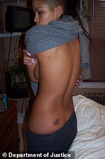 Cassie also showed images of her bruises that she alleged were inflicted by the rapper