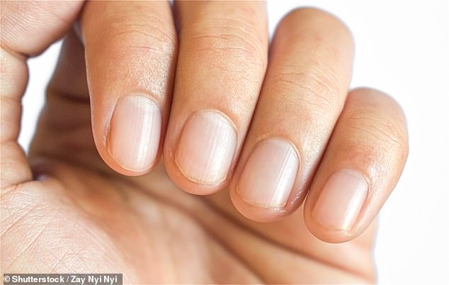 Telltale signs of finger clubbing include softening of the nail, red and shiny skin around the nail and ridges along the length of it, according to Cancer Research UK