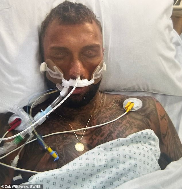 Mr Wilkinson was placed in a medically induced coma after suffering the side effects of years of steroid use