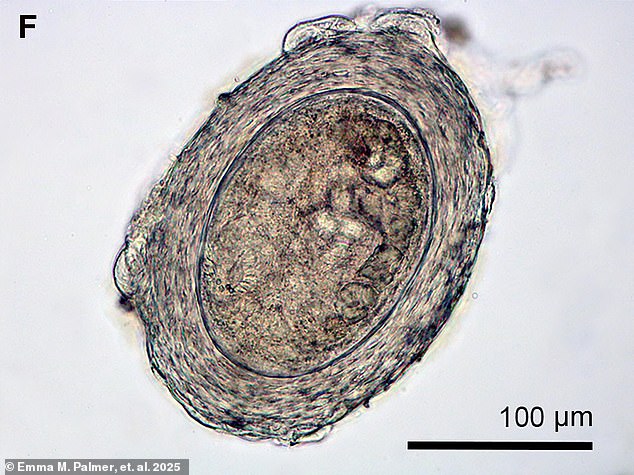 When fish is improperly cooked or frozen, the trematodes can survive and then infect the human body when eaten