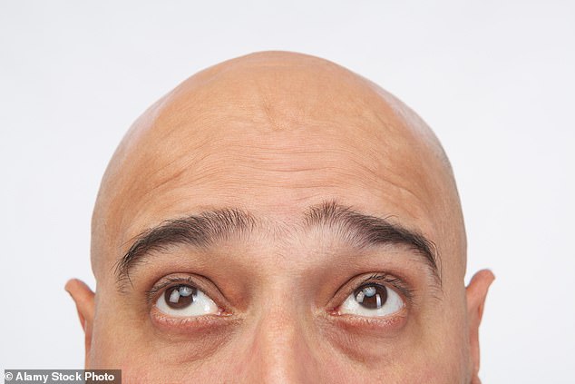 Losing your hair is something that many men dread. But there's good news, as experts are one step closer to a treatment that could help blokes hang on to their locks a little longer (stock image)