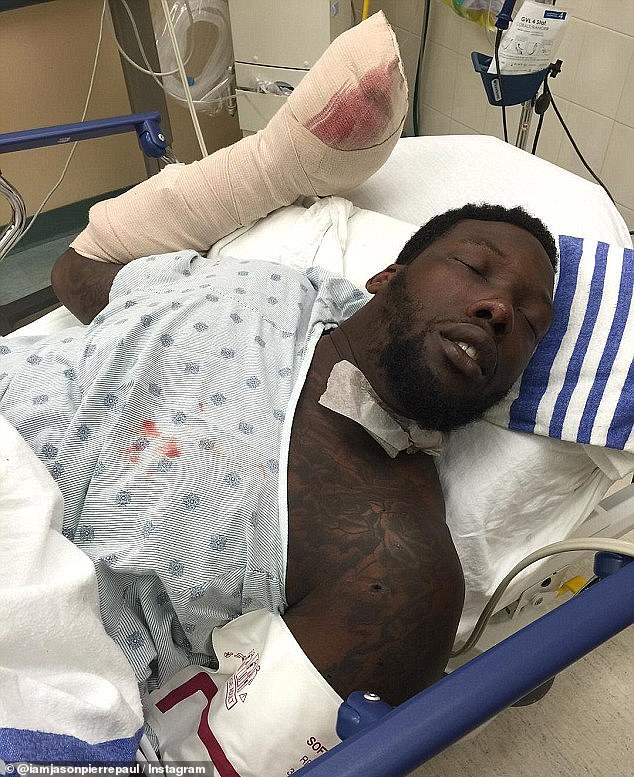 NFL defensive end Jason Pierre-Paul (pictured) lost multiple fingers and only has partial use of his right hand following a Fourth of July fireworks accident in 2015