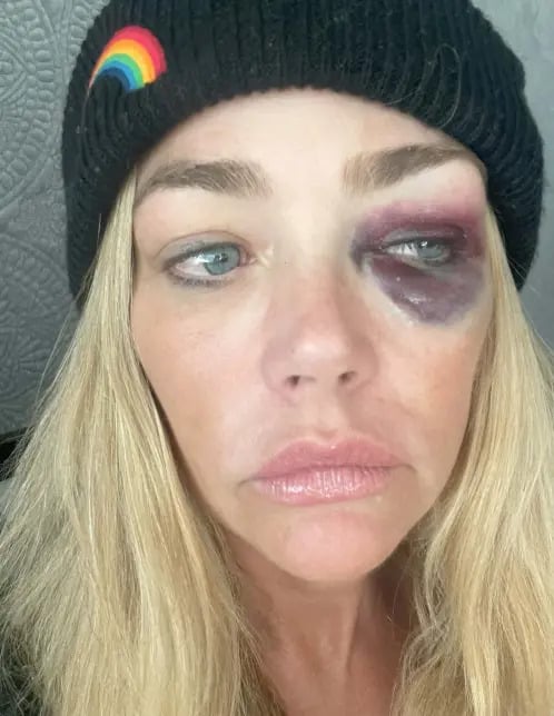 Aaron Phypers friend blasts Denise Richards claims of physical abuse