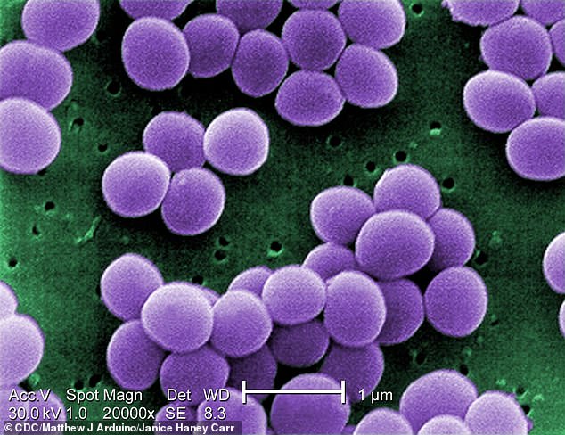 Under a very high magnification of 20,000x, this scanning electron micrograph (SEM) shows a strain of Staphylococcus aureus bacteria, which can cause a variety of clinical diseases
