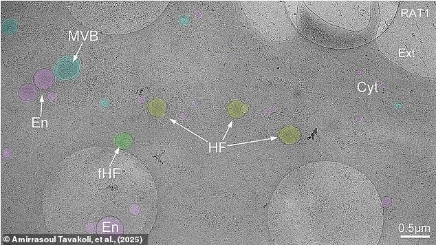 At just 200 to 400 nanometres in diameter, hemifusoles (labelled HF) are about a fifth of the size of a mitochondria. Scientists needed to use a technique called cryo-electron tomography to spot them