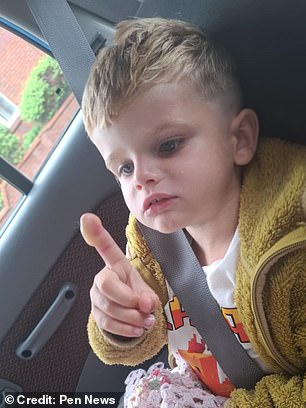Brooklyn Bone, three, was probably exposed to giant hogweed while picking flowers on the way to childcare in Newcastle upon Tyne