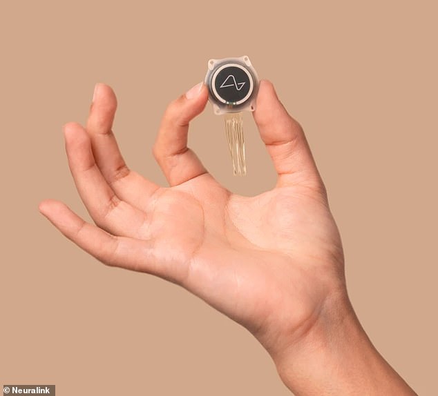 Neuralink's N1 implant (pictured) is the size of a quarter, with dozens of threads carrying electrodes which interpret neural activity in the brain