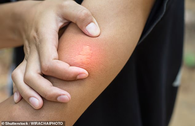 The sting is designed as a self-defence mechanism but, unlike bees, wasps can sting multiple times (stock image)