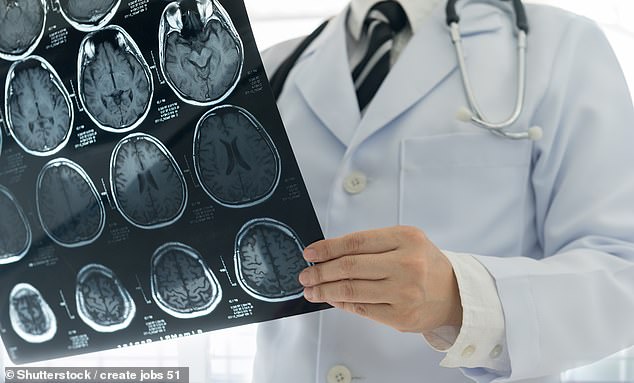 Using MRI scans, researchers compared the brains of 39 adult men with high psychopathy scores to those of a control group, and what they found was unsettling