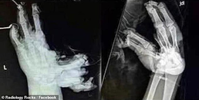 'This is the last weekend someone in the USA will have all 10 fingers,' the post on Facebook noted