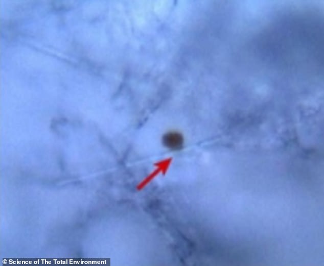 Tiny bits of microplastic, seen here as the black dots, have also been previously found in semen samples as part of a Chinese trial