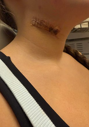 One of the victims, identified only as L.S. in court papers, claims Butler became physically violent if she rejected his sexual advances and even strangled her unconscious, nearly killing her