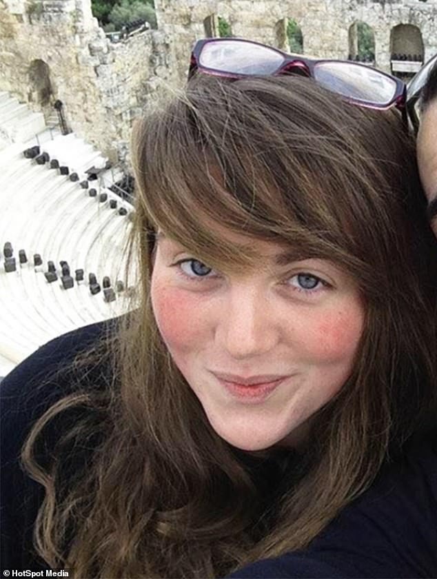 Doctors discovered Robyn had suffered a severe reaction to paraphenylenediamine (PPD), a common ingredient in hair dye