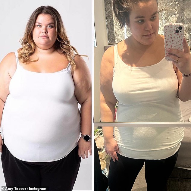 It comes after Amy revealed that she was using weight loss jabs after she 'felt there was nothing else I could do'