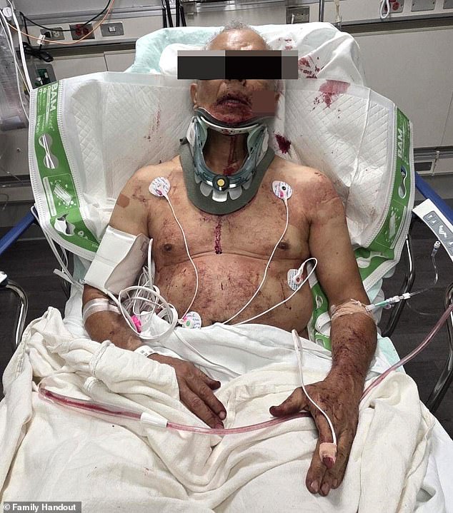 A grease truck driver, identified in court documents as only P.T., is seen lying in a hospital bed, covered in blood with a huge gash on his face and a brace around his neck