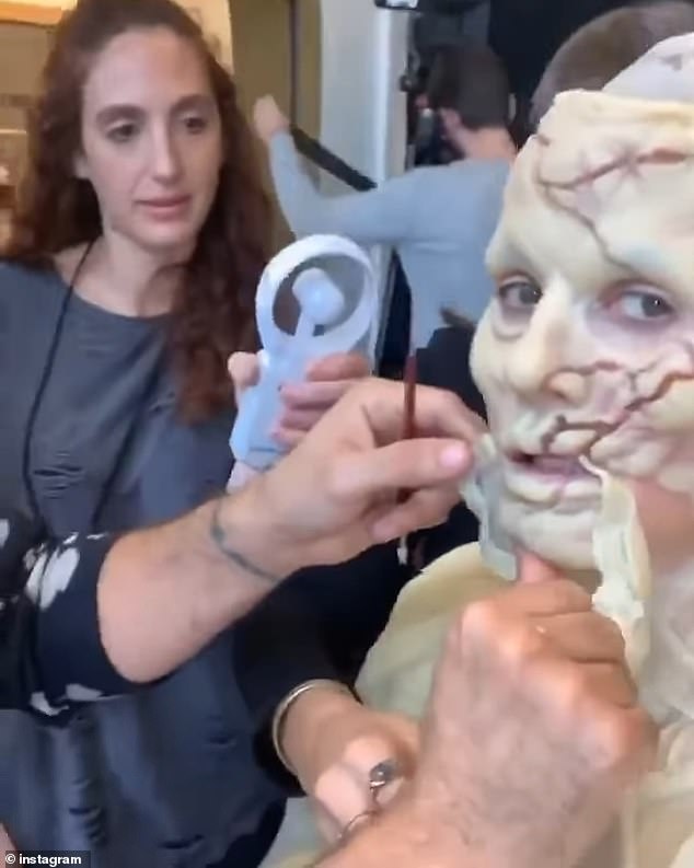 She had prosthetics put on her face