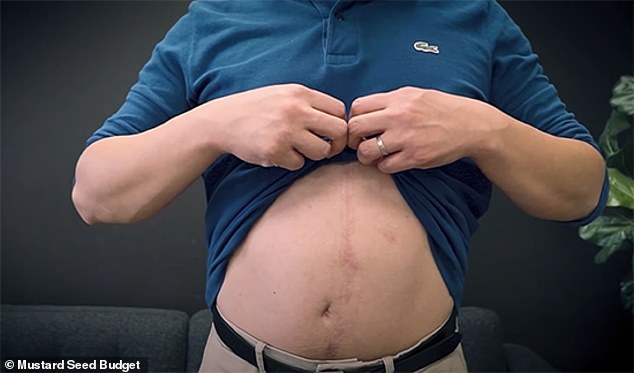 His stomach also bears a large scar as a result of his suicide attempt - doctors said it was a miracle he survived