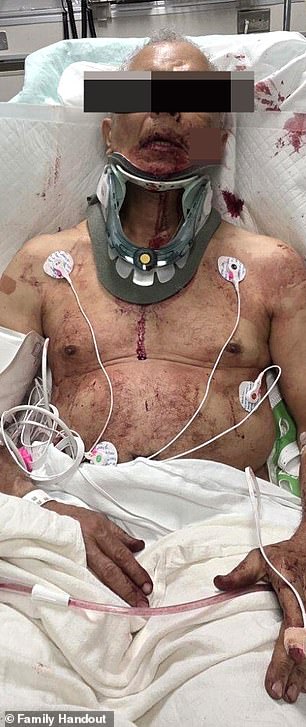 Perry Tole, a grease truck driver, is seen lying in a hospital bed, covered in blood with a huge gash on his face and a brace around his neck