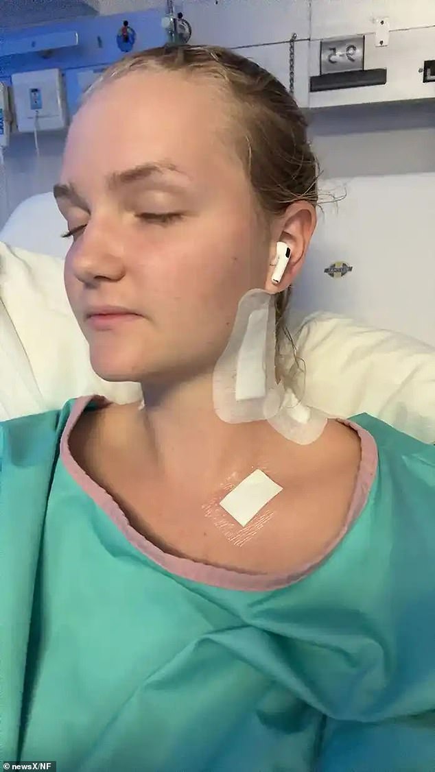 Naemi also broke her hand when she fell from the horse