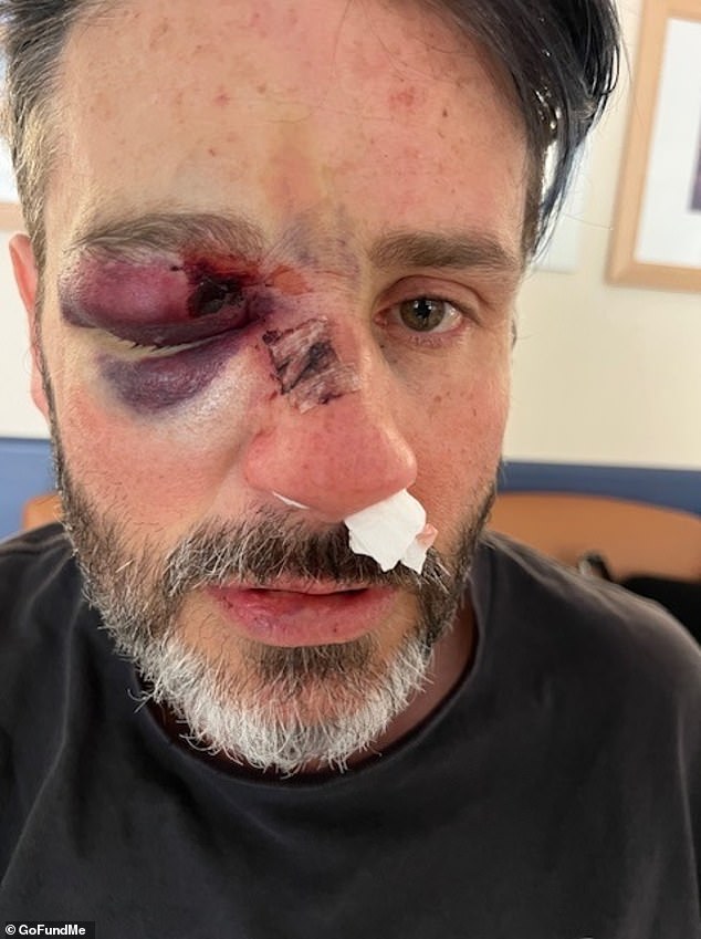 Kerr, seen here, suffered a traumatic brain injury, lacerations to his face and broken bones