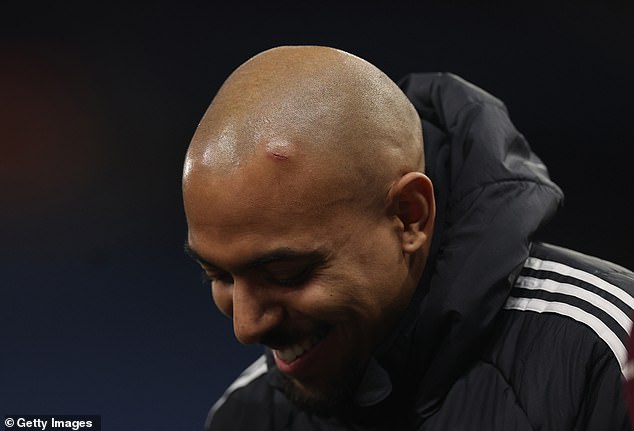 Malen's cut came up in a lump after the final whistle but the Netherlands international was in high spirits after scoring both goals