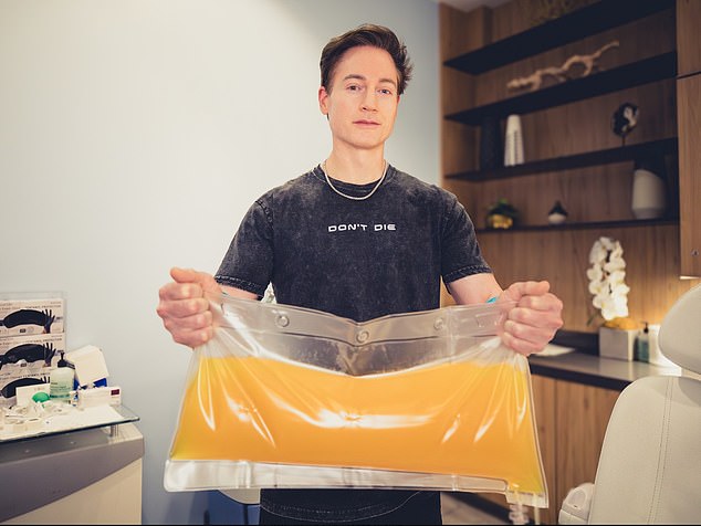 Bryan Johnson, also 48, is shown above after trying TPE in October last year. He is holding a sack containing the blood plasma that was filtered out of his body