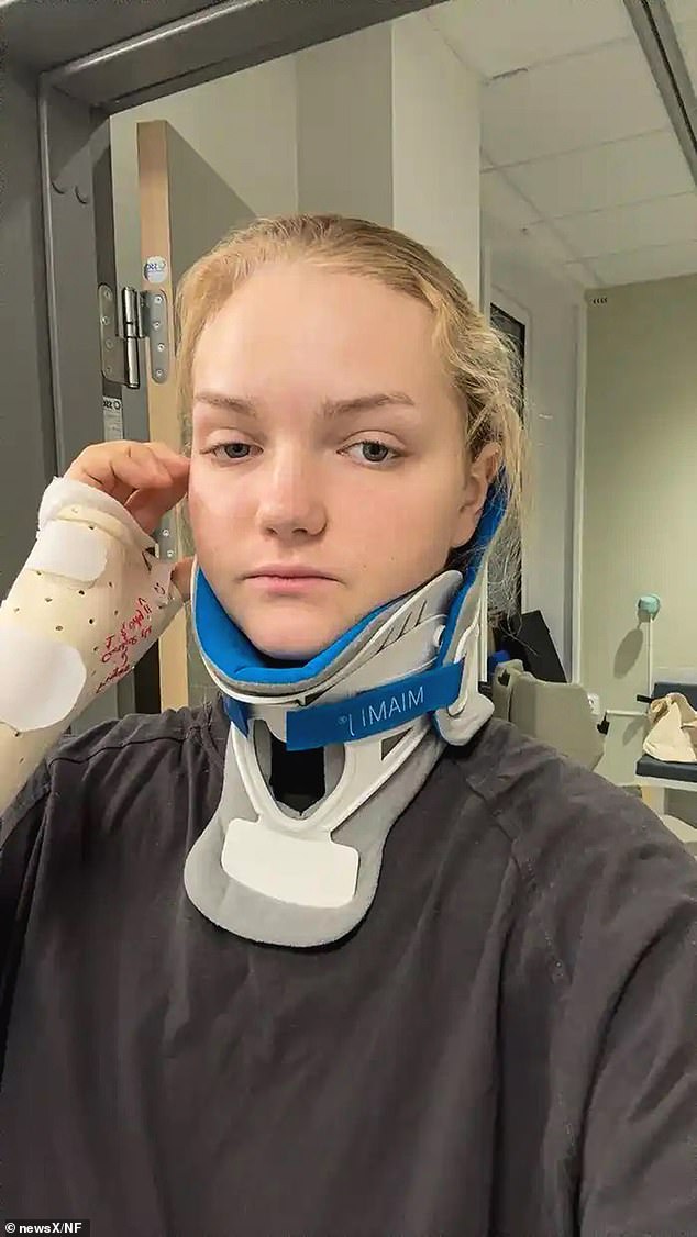 A 21-year-old woman was bitten in the neck by a lion after being dragged off a horse during a South Africa safari - but miraculously survived