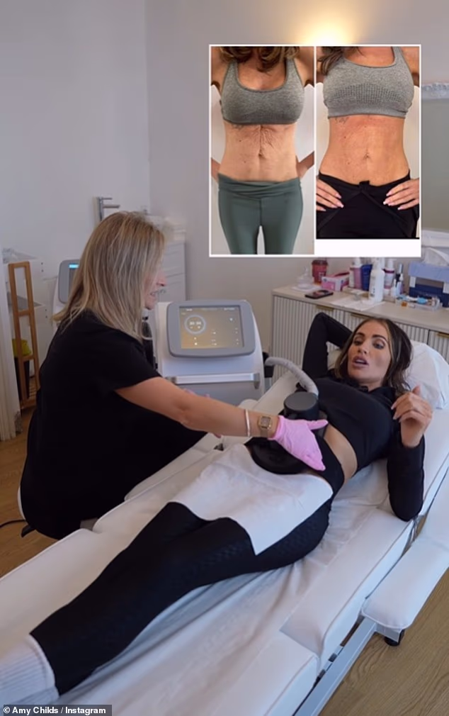 'I honestly couldn't be happier,' Amy said as she shared the results on Instagram on Thursday. 'As you know, I've always been conscious of the crepey skin'