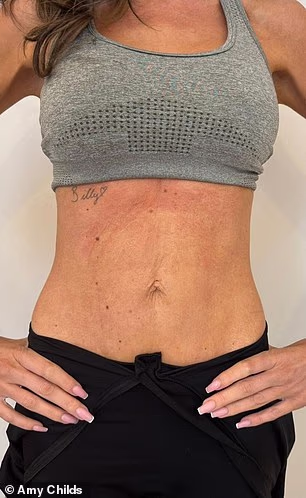 Amy has now shared incredible before and after snaps of her stomach