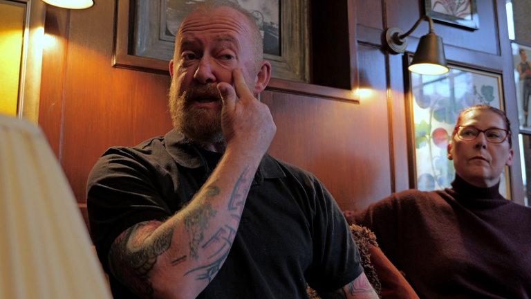 RAF veteran Pete Lewis points out scars on his face