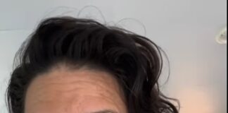 Lost star Evangeline Lilly ‘spent a lot of money’ to ‘remedy deficiencies in my brain’ after traumatic injury