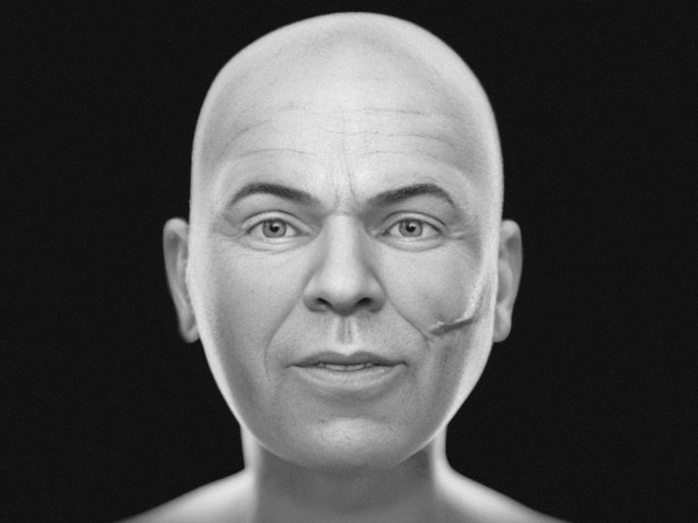 The objective version of the reconstructed face. Pic: Cicero Moraes