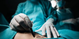 Brazilian butt lifts ‘should be banned immediately’ by government, MPs say | Politics News