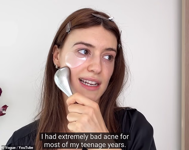 The actress, 27, shared that she was diagnosed with the condition at the age of 24 while taking fans through her day-to-night beauty routine in a new YouTube video with Vogue released on Tuesday