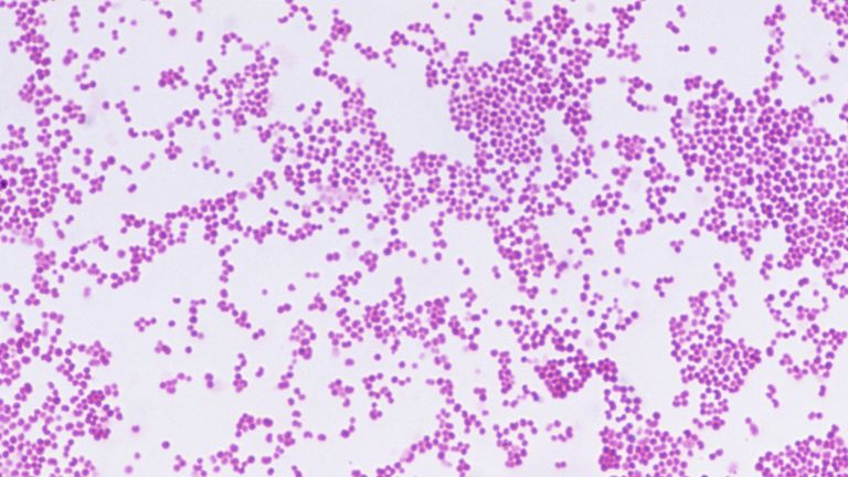 Pic: CNRI/Science Photo Library